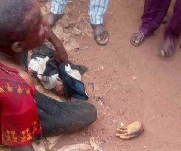 Fulani Herdsman Chops Off Farmers Hand And Ear In Kogi (photo)